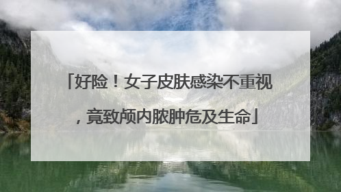 好险！女子皮肤感染不重视，竟致颅内脓肿危及生命